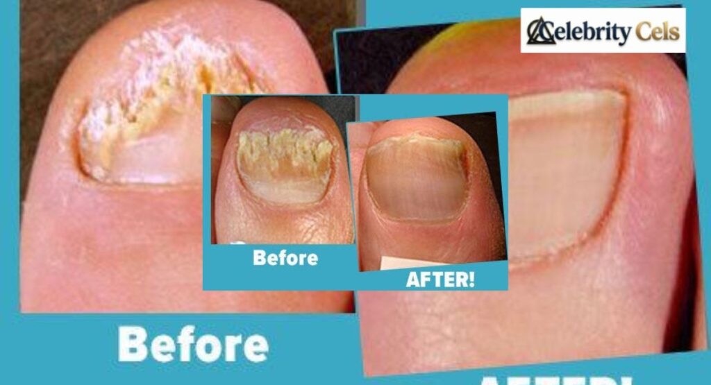 Crystal Flush Reviews 2025 : Honest Toenail Fungus Treatment Insights